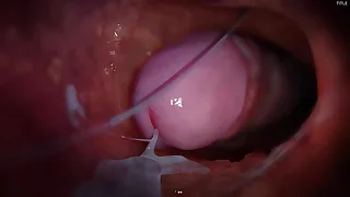 China Twink XXX Tube 4